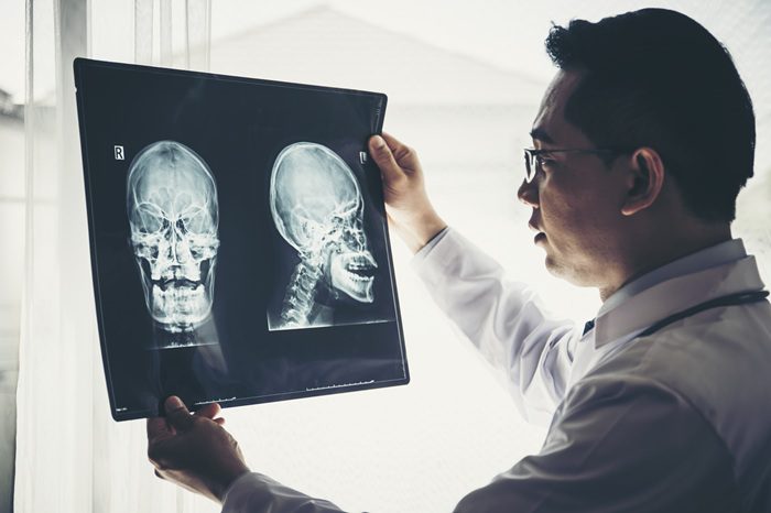 Close up of doctor holding x-ray, x-ray film of patient at hospital.