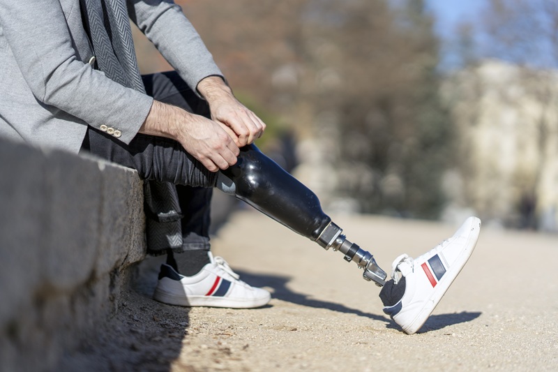 A man with a prosthetic leg. He may have suffered an amputation injury at work or in another setting.